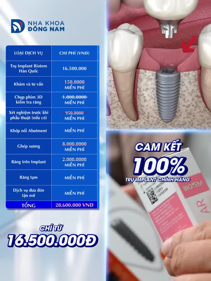 Trồng răng Implant - Hưởng trọn 6 đặc quyền, chăm sóc trọn đời