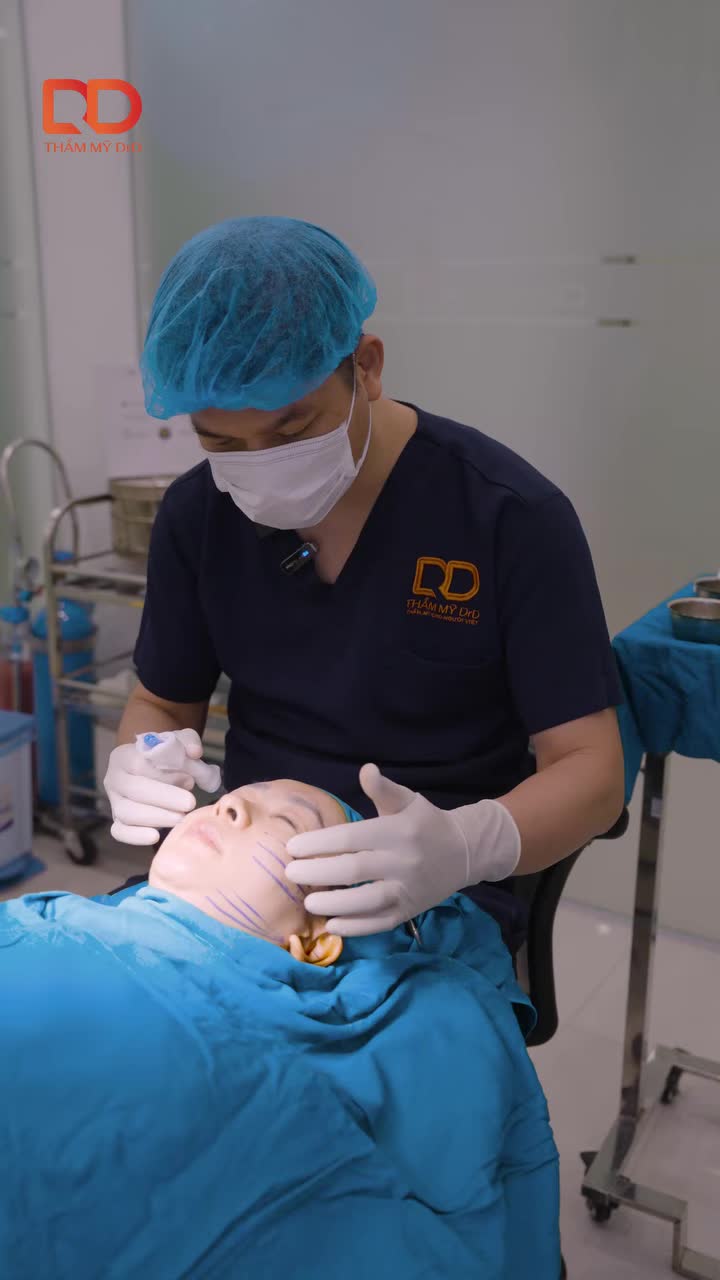CĂNG CHỈ TOÀN MẶT - NÂNG CƠ, XÓA NHĂN, TẠO HÌNH MẶT VLINE