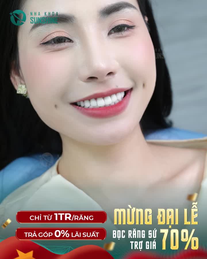 BỌC RĂNG SỨ CHỈ TỪ 1 TRIỆU/RĂNG MỪNG ĐẠI LỄ 30/4 -1/5, SUNSHINE đồng hành cùng NỤ CƯỜI VIỆT