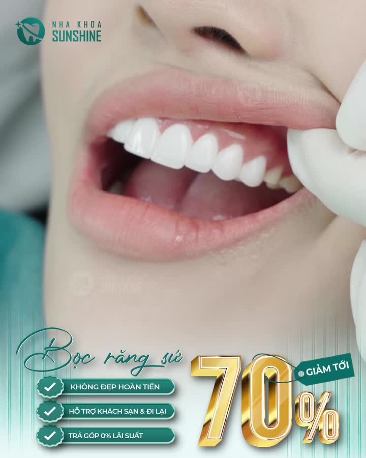 BỌC RĂNG SỨ KHÔNG MÀI NHỎ ƯU ĐÃI 70% Chỉ còn 19 SUẤT cuối