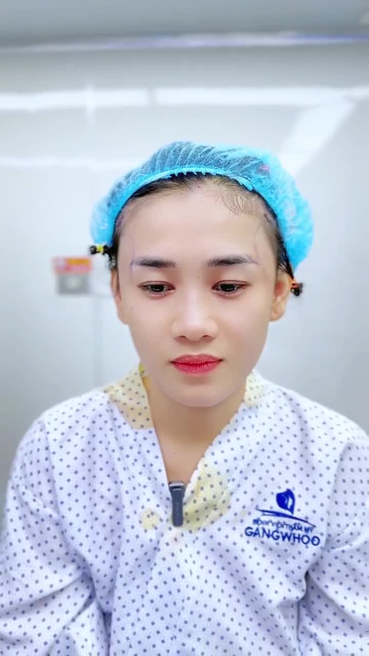 BƯỚC NGOẶT ĐỔI ĐỜI – BẠN H TRẺ TUỔI TỰ TIN HƠN SAU ĐỘN THÁI DƯƠNG TẠI GANGWHOO!