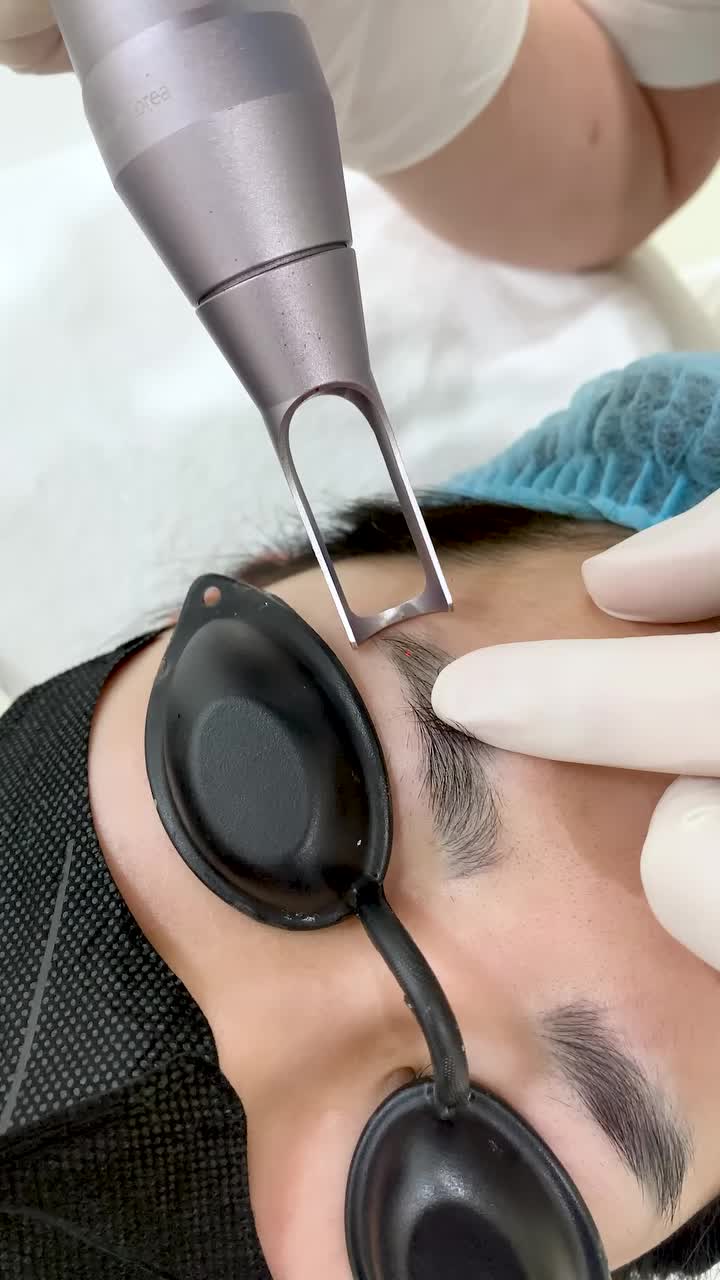 Công nghệ Laser tiên tiến tại Viện Thẩm Mỹ Xuân Hương giúp loại bỏ mực nhanh chóng, an toàn, hiệu quả.
