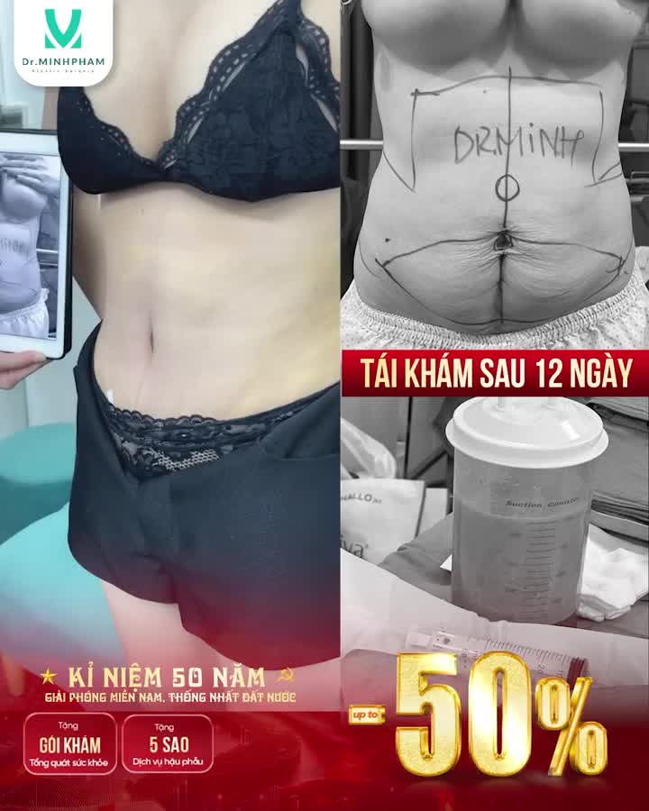 TÁI KHÁM SAU 12 NGÀY – KHÁCH HÀNG “LỘT XÁC” NGOẠN MỤC