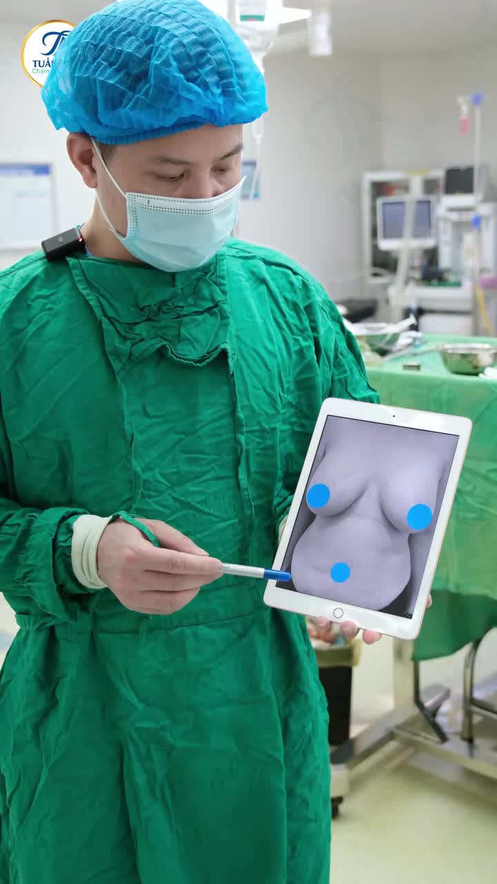 Chị H. (50 tuổi, Hà Nội) từng đặt túi vòng 1 cách đây 10 năm. Gần đây, chị gặp tình trạng sa trễ, phì đại vòng 1 – gây mất thẩm mỹ và ảnh hưởng đến cuộc sống.
