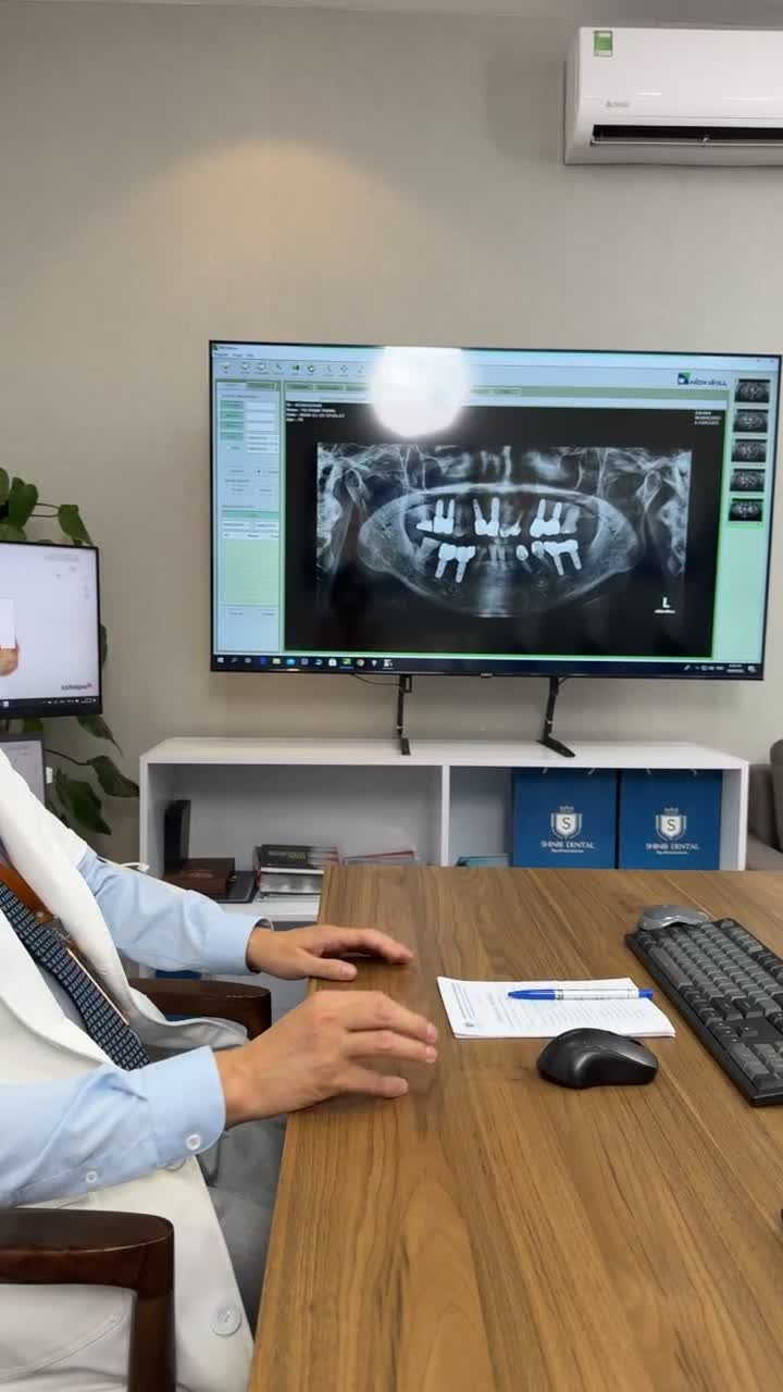 Bác sĩ Nguyễn Văn Hòa thực hiện ca cấy răng Implant cho khách hàng 85 tuổi – ông Vũ Đoàn Thăng