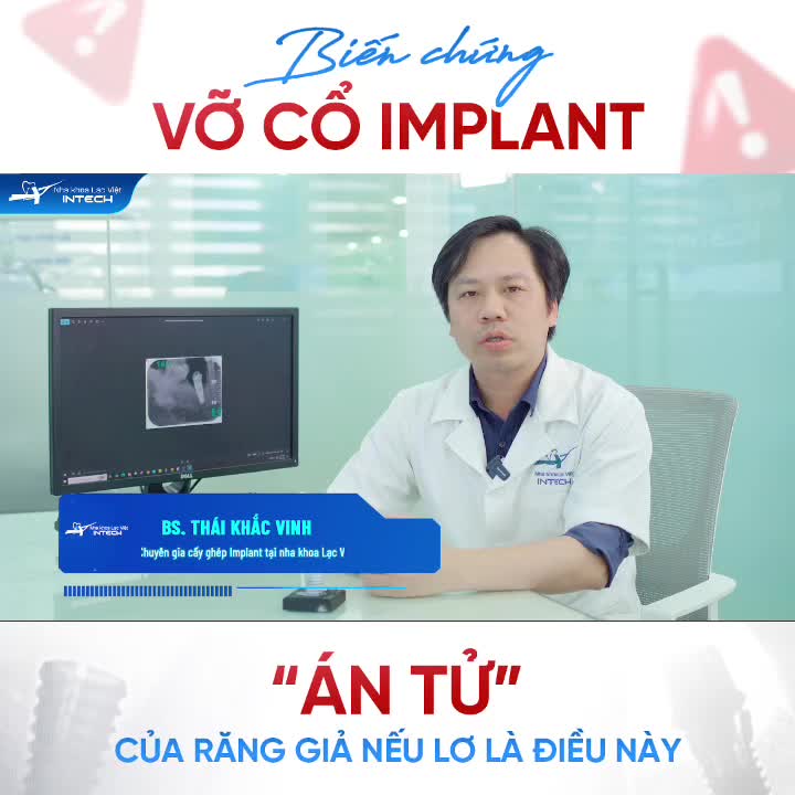 "ÁN TỬ" CỦA RĂNG GIẢ: BIẾN CHỨNG VỠ CỔ IMPLANT NẾU LƠ LÀ ĐIỀU NÀY!