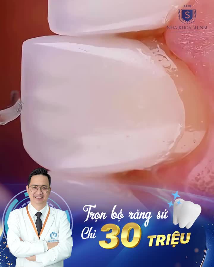 DÁN SỨ VENEER PHONG THUỶ –,MỞ LỐI THÀNH CÔNG ƯU ĐÃI KHỦNG - TRỌN BỘ CHỈ 30 TRIỆU CAM KẾT KHÔNG MÀI NHỎ - KHÔNG ĐAU - KHÔNG HÔI MIỆNG TRẢ GÓP 0% LÃI SUẤT – Chỉ cần CCCD