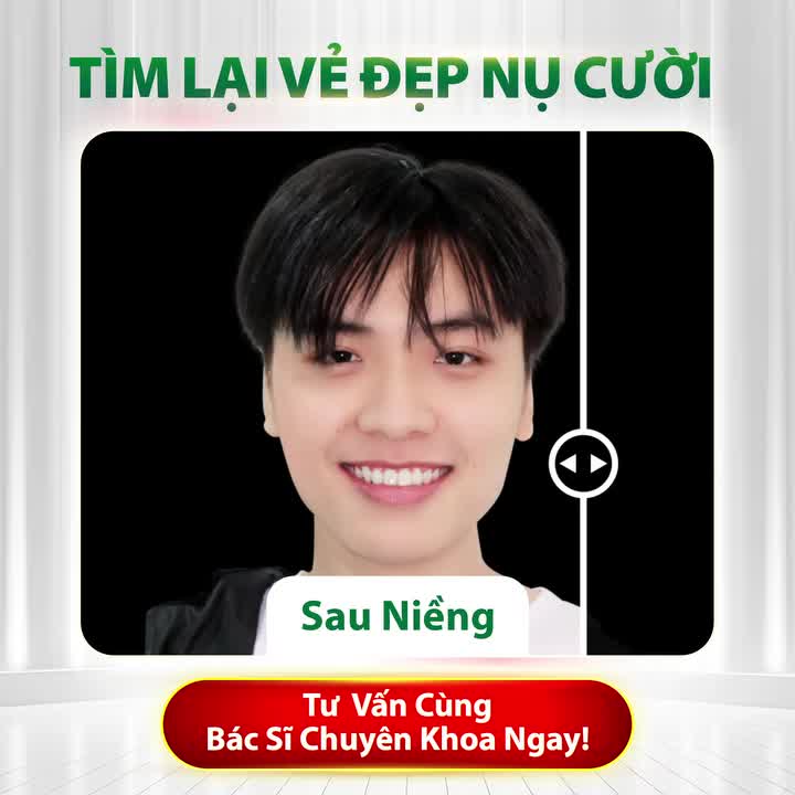 BẠN CÓ ĐANG HÀI LÒNG VỚI NỤ CƯỜI HIỆN TẠI CỦA MÌNH?