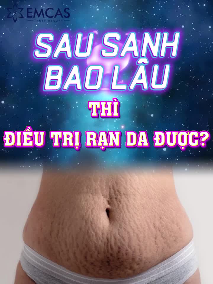 Rạn da sau sinh là vấn đề vô cùng phổ biến ở các mẹ bỉm sữa. Việc điều trị sớm sẽ giúp tăng hiệu quả và rút ngắn thời gian phục hồi.