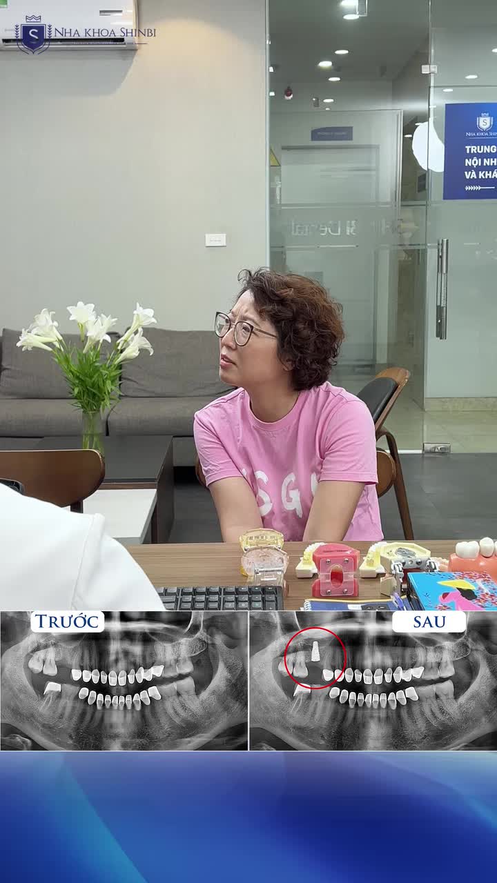TRỒNG RĂNG IMPLANT PHÙ HỢP CHO PHỤ NỮ U50.