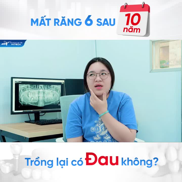MẤT RĂNG SỐ 6 SUỐT 10 NĂM – TRỒNG LẠI CÓ ĐAU KHÔNG?