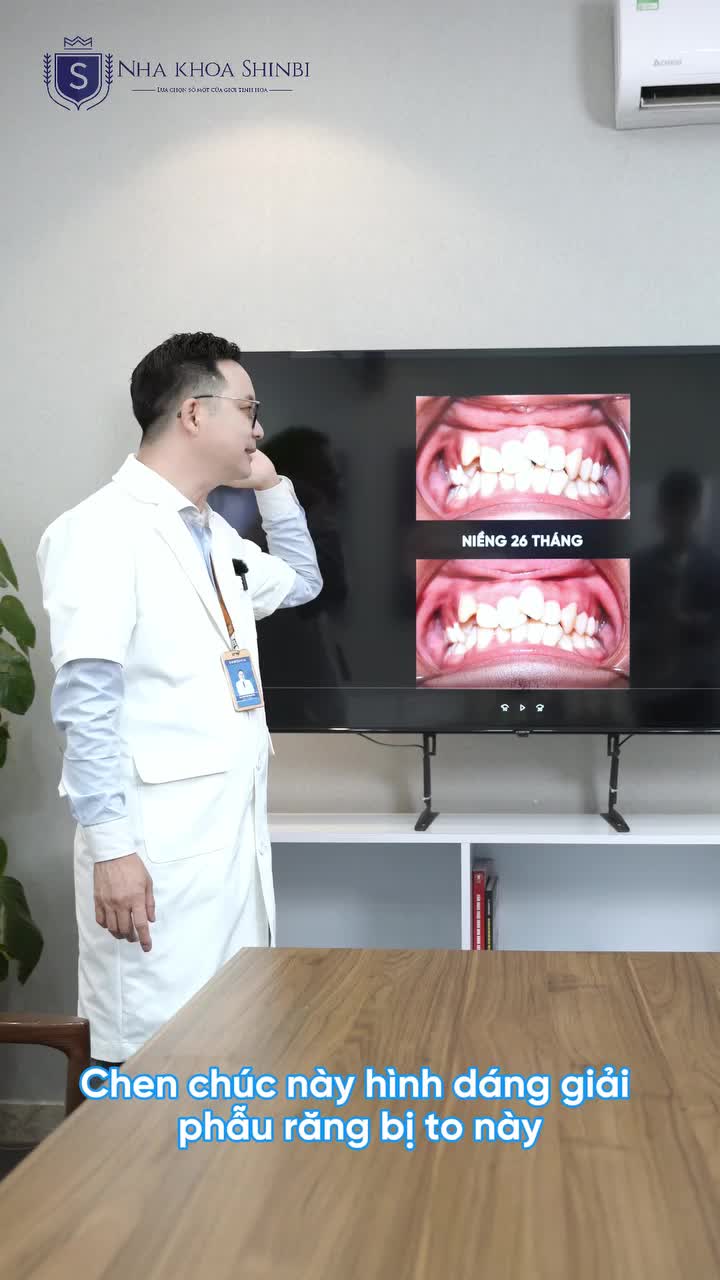 NIỀNG RĂNG CHỈNH NHA: HIỆU QUẢ CAO – CHI PHÍ PHÙ HỢP