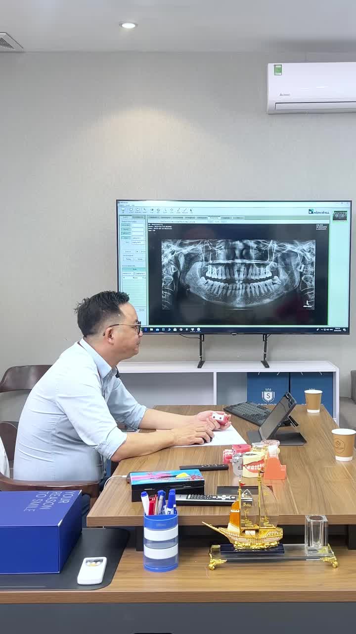 TRƯỜNG HỢP CHỈ ĐỊNH ĐIỀU TRỊ RĂNG 3-7 NHỔ RĂNG 3-8, 4-8 DO SÂU, ĐAU BUỐT