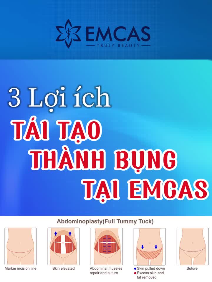 3 LỢI ÍCH SỨC KHỎE MÀ TÁI TẠO THÀNH BỤNG TẠI EMCAS MANG ĐẾN CHO BẠN