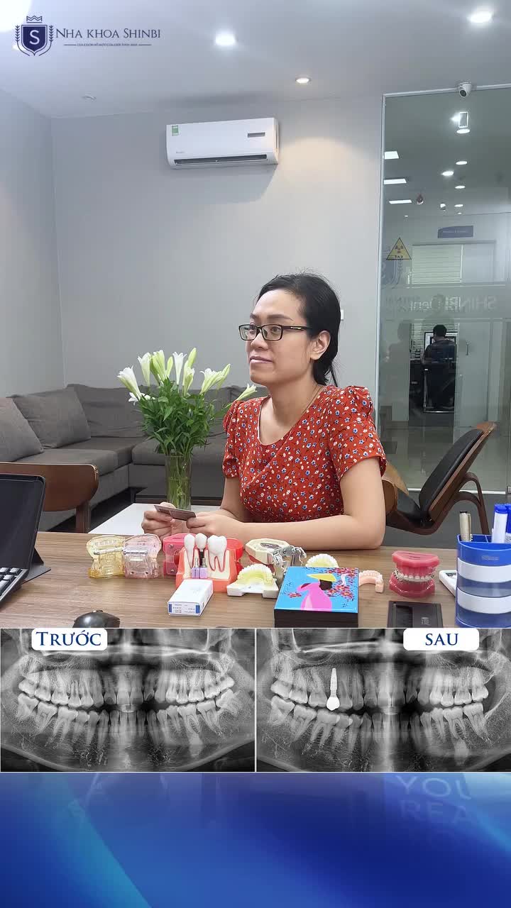 CHĂM SÓC – LÀM SẠCH RĂNG MIỆNG SAU TRỒNG RĂNG IMPLANT