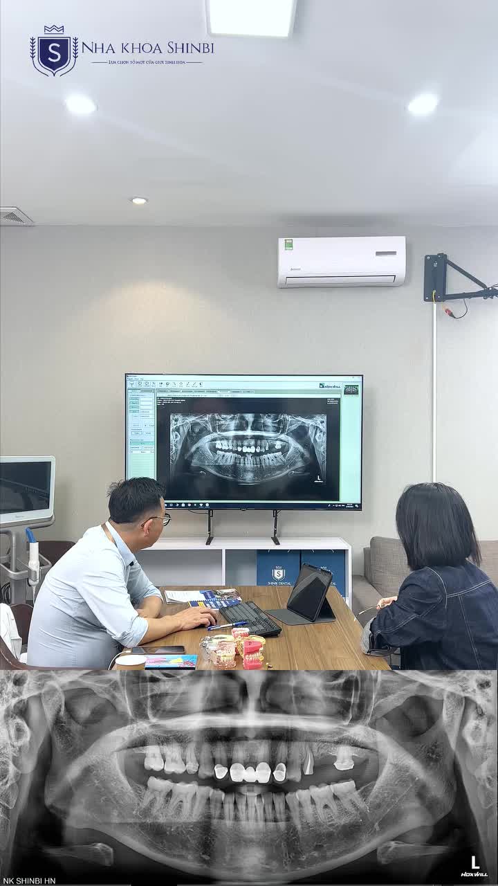 ĐIỀU TRỊ VIÊM LỢI MÃN TÍNH + TRỒNG RĂNG IMPLANT