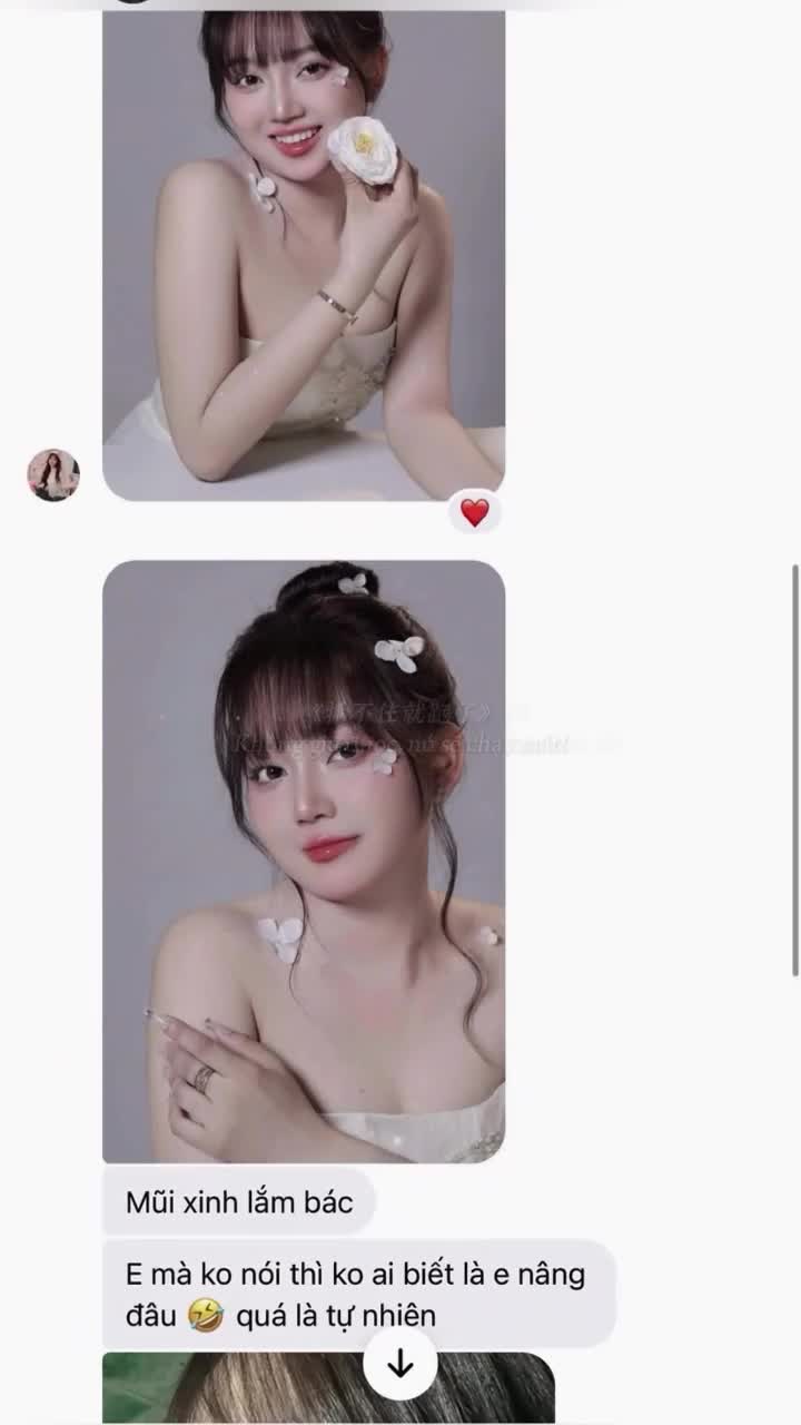 Sau 2 tháng thực hiện combo mũi lót sụn + cắt cánh, nàng khách tại Charming giờ đây xinh như nàng thơ bước ra từ studio!