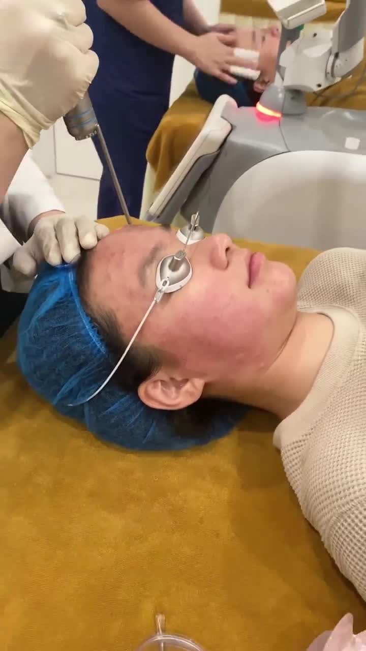 KHÁCH HÀNG ĐIỀU TRỊ MỤN BẰNG LASER TẠI DRD