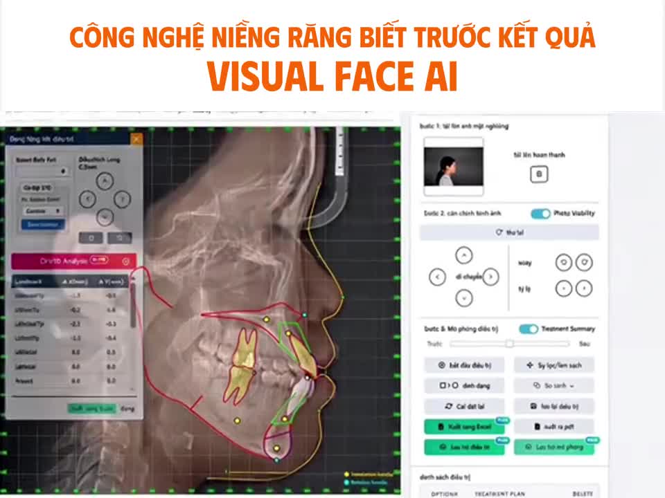 KHÔNG CÒN CẢM GIÁC “LIỀU MÌNH” KHI NIỀNG RĂNG