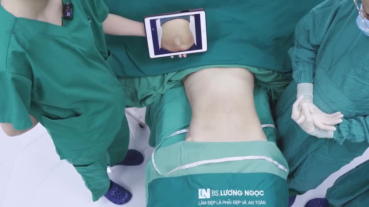 HÚT MỠ CO DA TẠM BIỆT MỠ THỪA, ĐÓN BỤNG PHẲNG, KHÔNG SẸO