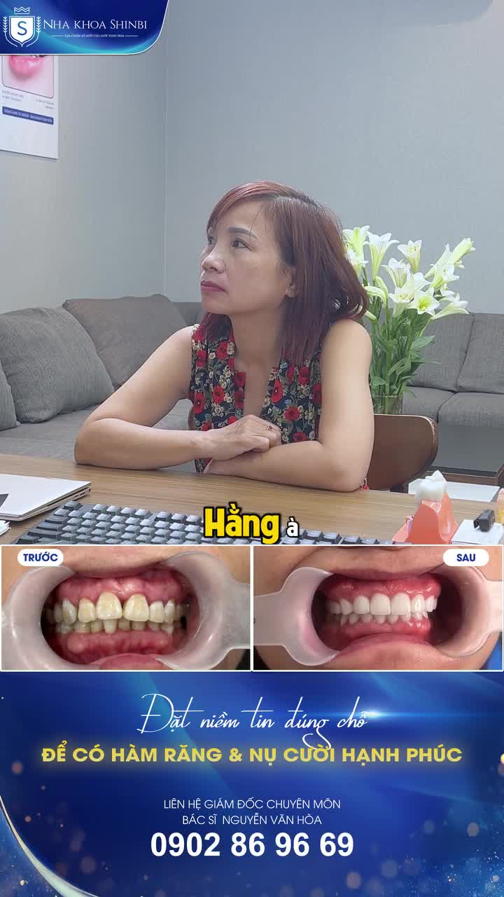 NHƯ TRẺ LẠI 10 TUỔI KHI CÓ HÀM RĂNG ƯNG Ý