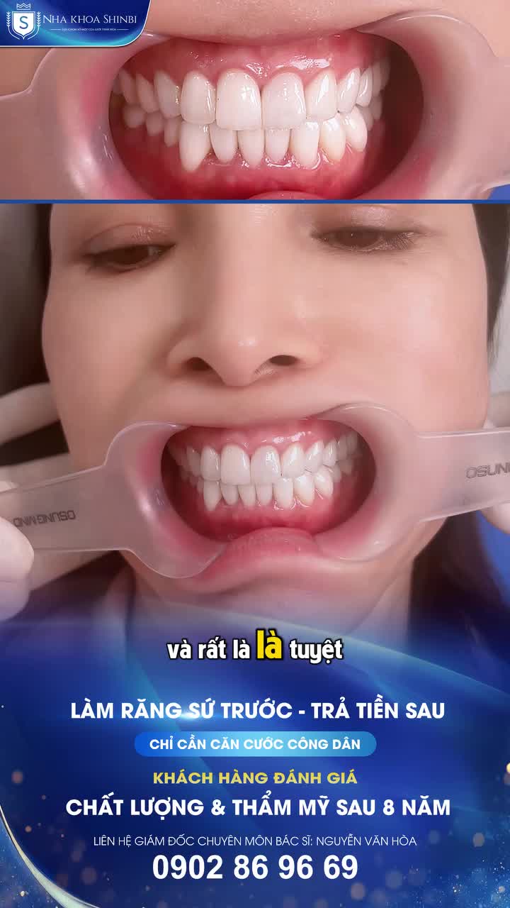 SAU 8 NĂM LÀM RĂNG SỨ TẠI SHINBI – VẪN TUYỆT VỜI NHƯ NGÀY ĐẦU