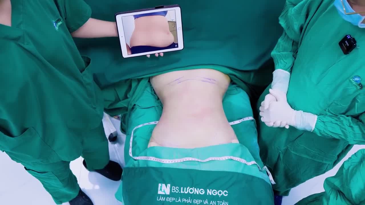 CHƯA TỪNG SINH CON – CÓ NÊN HÚT MỠ?