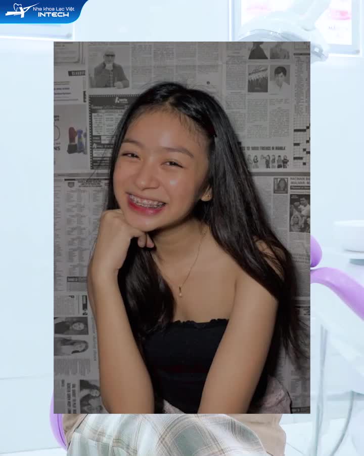 TẠM BIỆT MẮC CÀI - TUỔI 15 "GLOW UP" TỰ TIN XINH TƯƠI HẾT NẤC
