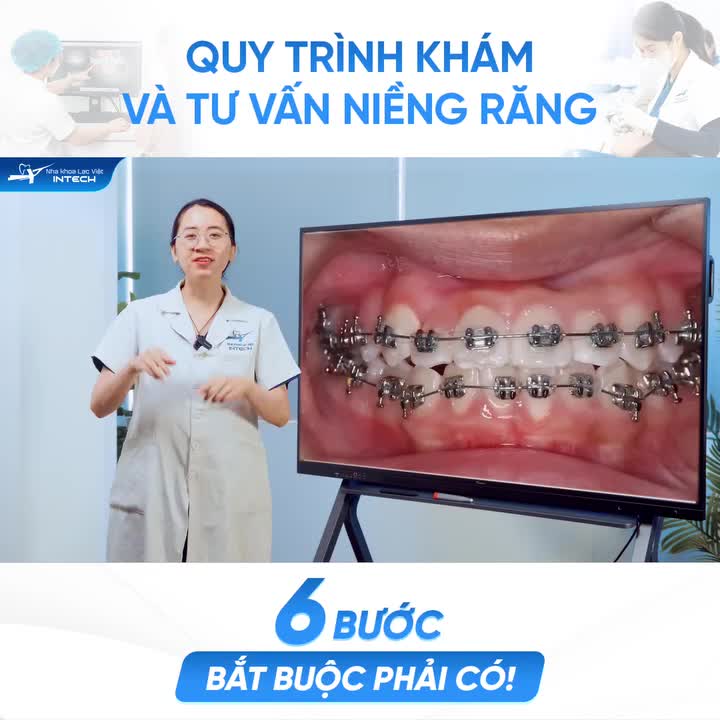CHI TIẾT 5 BƯỚC TRONG QUY TRÌNH NIỀNG RĂNG - AI SẮP NIỀNG NHẤT ĐỊNH PHẢI XEM!