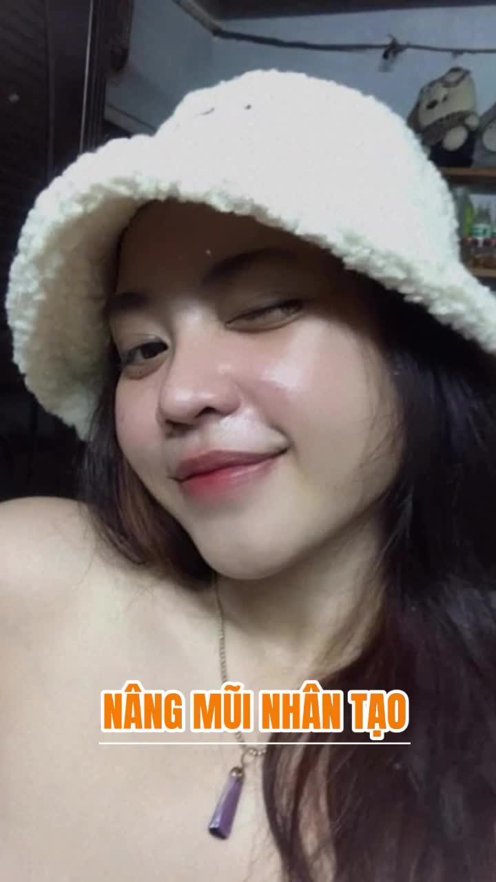 Hơn 1 tháng trôi qua, dáng mũi đã ổn định, da dẻ mịn màng, thần thái thì xinh tươi rạng rỡ. Nhìn nàng cười là biết hài lòng cỡ nào với diện mạo hiện tại rồi nà!