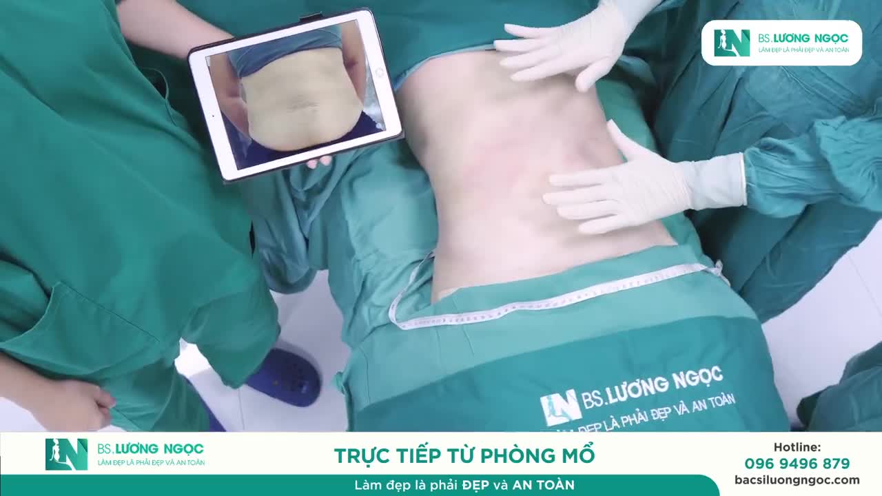 KHÁCH HÀNG SAU NHIỀU LẦN SINH – LỘT XÁC VÒNG EO, HOÀN THIỆN VÒNG 1