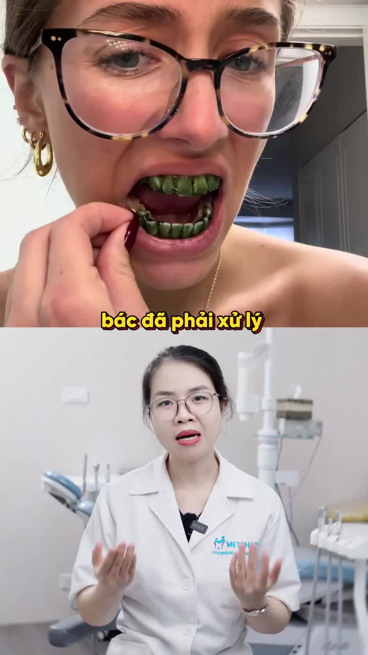TỰ TẨY TRẮNG RĂNG TẠI NHÀ CÓ ĐƯỢC KHÔNG
