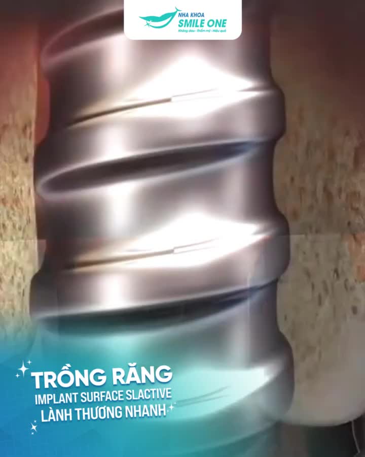 Mất răng khiến việc sinh hoạt, ăn nhai khó khăn, thậm chí ảnh hưởng đến cả thẩm mỹ khuôn mặt.