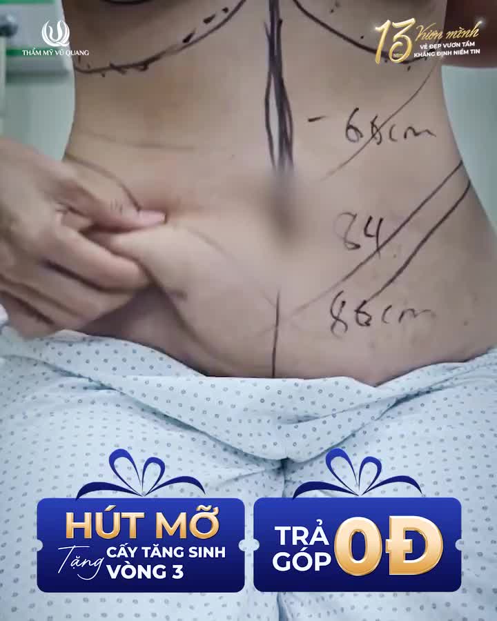 GIẢM 35KG NHƯNG HÌNH THỂ VẪN KHÔNG NHƯ MONG MUỐN…