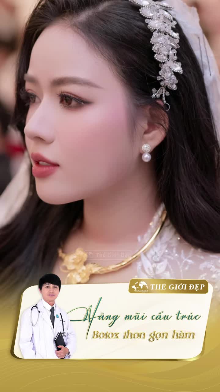 Kết quả sau 7 ngày nâng mũi và Botox hàm