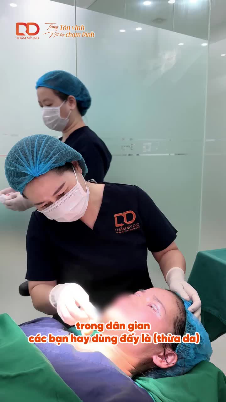 Mắt sụp mí, nhiều da thừa… nhưng sợ cắt mí đau, sưng lâu hay bị giả?