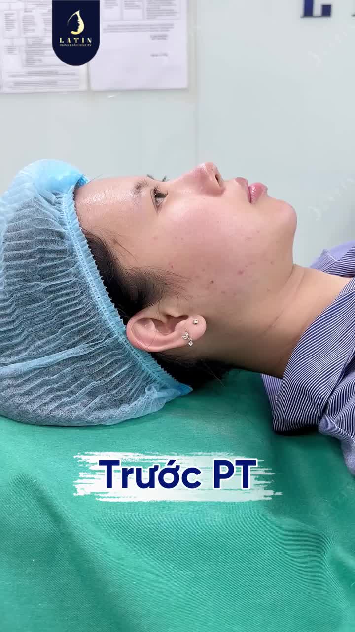 ĐỘN CẰM - THAY ĐỔI NHỎ, KHÁC BIỆT LỚN!