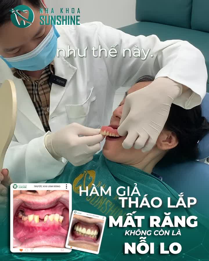 Có một loại răng giả khiến nhiều người lớn tuổi bất ngờ vì… đeo vào mà như răng thật! Xem video để biết đó là gì