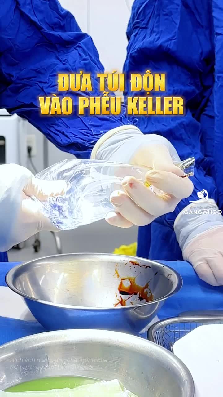 Đừng xem video này nếu bạn không muốn biết cách V3 được nâng cấp