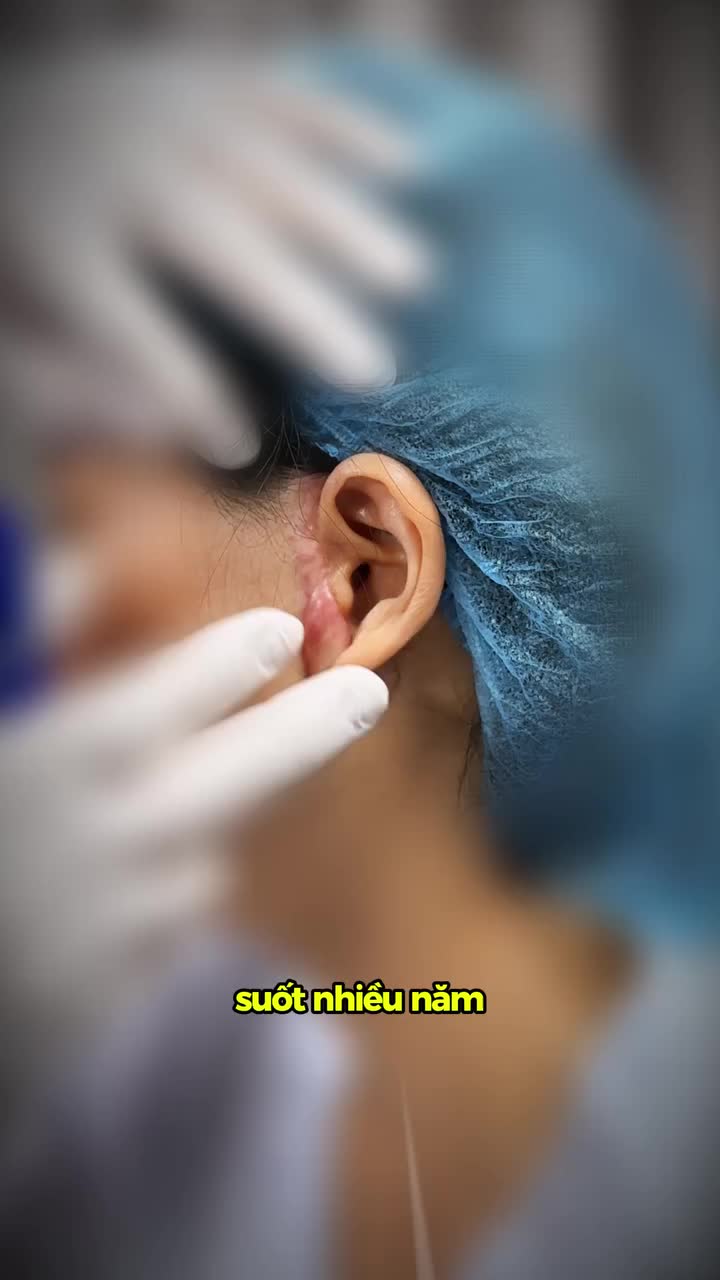 Tái sinh cho gương mặt bị bao trùm bởi sẹo khổng lồ