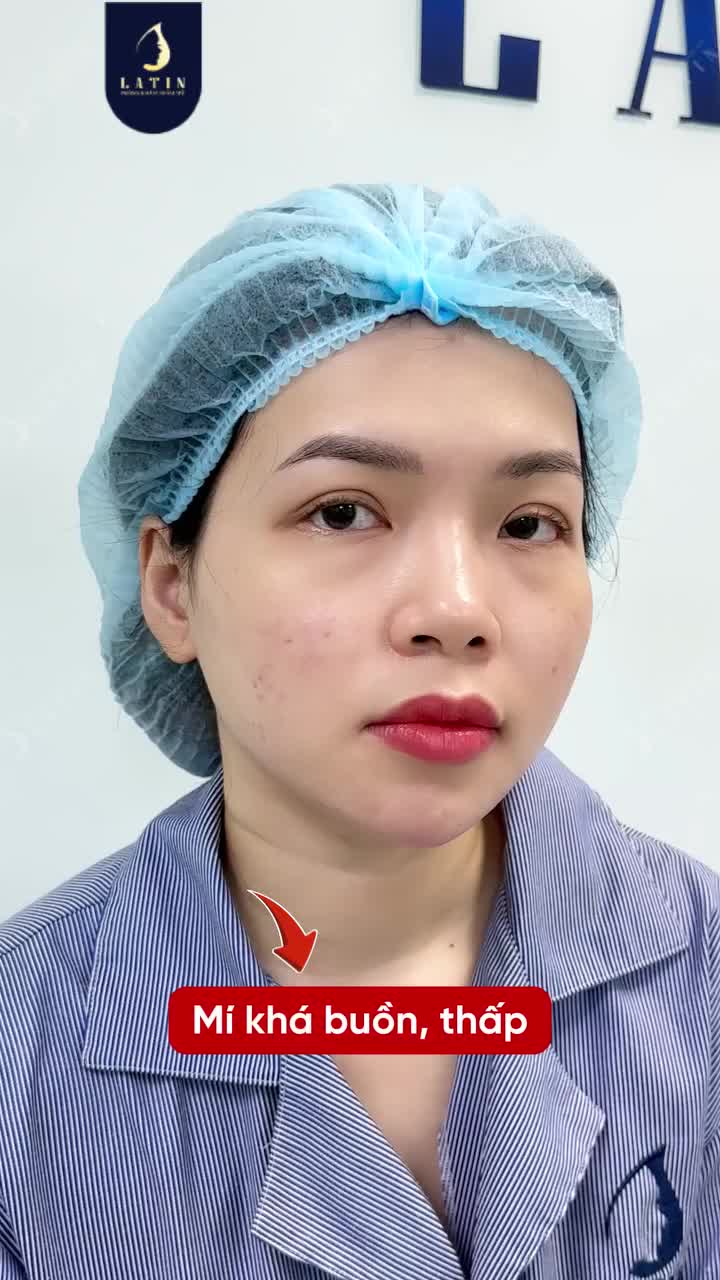 ĐÔI MẮT CŨ KHÔNG GIỮ LẠI - NỤ CƯỜI MỚI THÊM RẠNG NGỜI!
