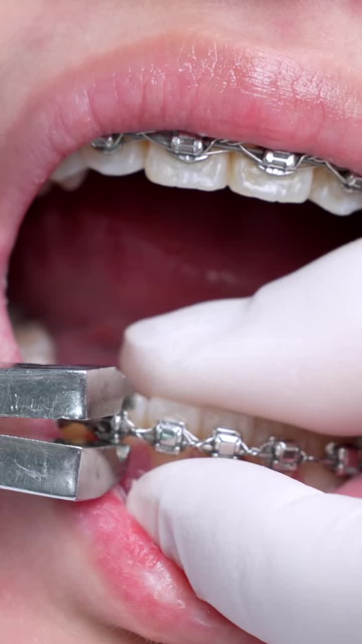KHOẢNH KHẮC THÁO NIỀNG – NỤ CƯỜI MỚI, TỰ TIN HƠN MỖI NGÀY