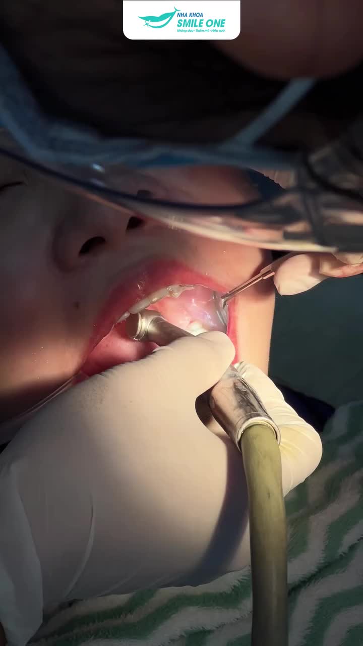 Nhiều lúc bảo nhổ răng 8 trong 20 giây mọi người không tin! Nay lên tiếp video để chứng minh nhá!