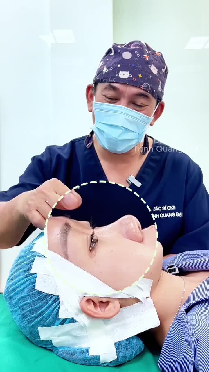 BÍ QUYẾT KHIẾN KHUÔN MẶT THANH TÚ HƠN CHỈ TRONG 90 PHÚT