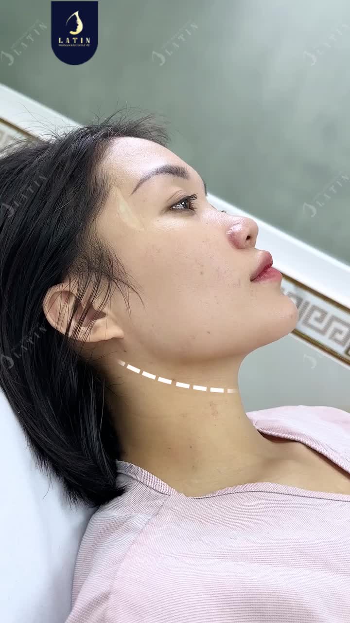 HƠN 20 NĂM CHƯA TỪNG BIẾT VÌ SAO GƯƠNG MẶT THIẾU ĐIỂM NHẤN