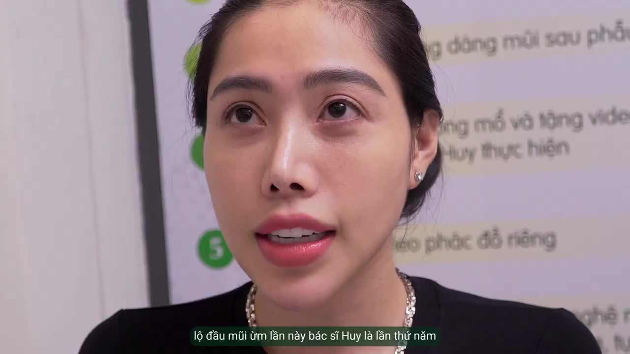 BÁC SĨ HUY PHÂN TÍCH CA MŨI ĐÃ SỬA 4 LẦN NƠI KHÁC NHƯNG VẪN KHÔNG ĐẸP – GIẢI PHÁP CUỐI CÙNG LÀ GÌ?