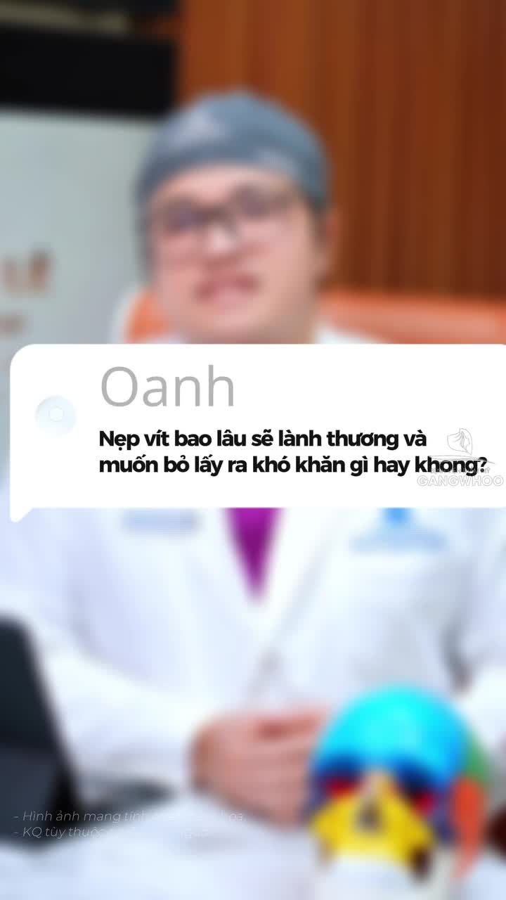 DMKT: Phẫu thuật chỉnh  sửa gò má - cung tiếp