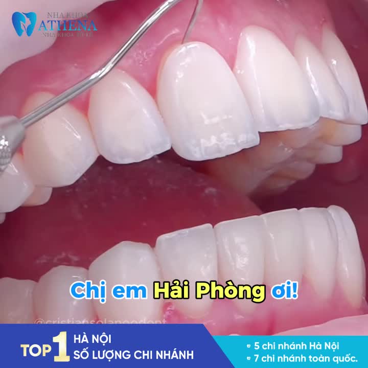 ƯU ĐÃI ĐỘC QUYỀN TẠI ATHENA HẢI PHÒNG