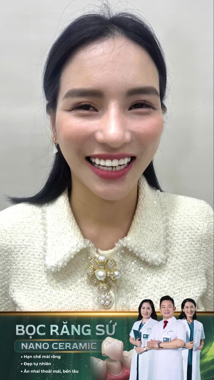 Tự tin hơn, xinh đẹp hơn sau bọc răng sứ