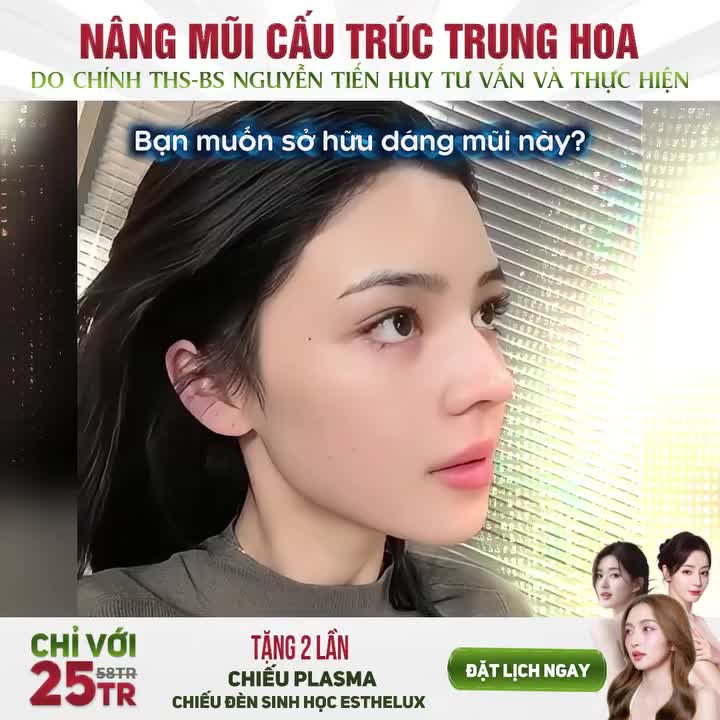 NÂNG MŨI CẤU TRÚC TRUNG HOA CHỈ VỚI 25TR - KHÔNG PHÁT SINH CHI PHÍ